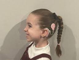 Abby's path to hearing; A family's experience with cochlear implants