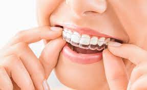 Clear retainers are relatively easy and. Do I Have To Wear A Retainer After Invisalign Sensational Smiles