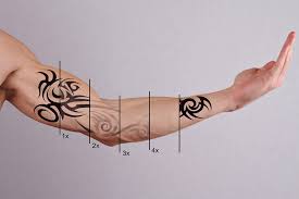 We have had excellent success removing tattoos that are primarily black or blue. Tattoo Removal