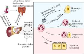 For example, in november 2014, researchers at the the best way to detect liver cancer is through surveillance ultrasound of the liver done by an oncologist every 6 months in a patient with a diagnosis of cirrhosis. Neutrophils In Liver Diseases Pathogenesis And Therapeutic Targets Cellular Molecular Immunology