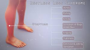 Image result for Restless Leg Syndrome