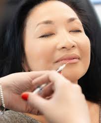 Facial Fillers in Englewood, NJ