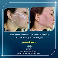 کوردی /عربی ئۆفەری تایبەت...