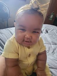 My wife and then son 3 years today she past and my son nine years at 28  weeks never met him