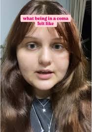 Marlee Green Amputee