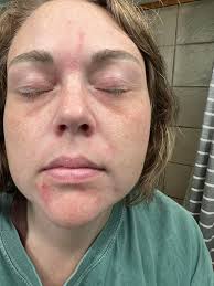 Anti aging magic oil, ☘️ This oil will erase all the wrinkles