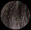 Pictures Of Lice In African American Hair