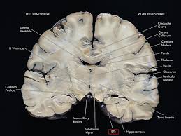 Permainan rp kpop idol sedang jadi sorotan karena viralnya kisah adora & hilman di media sosial. Frontiers Anatomy And Connectivity Of The Subthalamic Nucleus In Humans And Non Human Primates Frontiers In Neuroanatomy