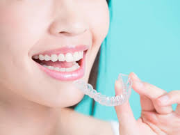 Invisalign Irvine CA | Certified Invisalign Provider in Irvine CA