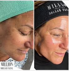 ✨✨ SATURDAY SPECIAL WITH MANDY ✨✨ 🪞 🪩 💎Glass Skin by The Million Dollar  Facial includes 9 incredible steps: The Million Dollar Facial Treatment  procedure is as follows: * Pre Cleanse *