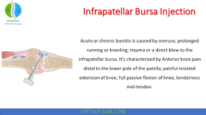 Image result for Prepatellar Bursa Injection