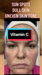 Maelove’s vitamin C the glow maker is the best!!! I started out using this  3 years ago when i started my skincare journey. I’ve tried different  products but nothing faded my sun spots like this did!! ...
