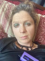 Struggling with bipolar disorder symptoms after injection