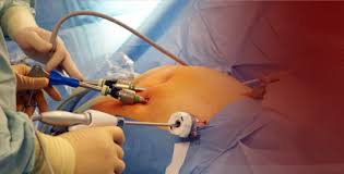 Dr Jimmy Lam Urological Laparoscopic Surgeon North Adelaide Sa