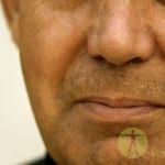 なんと 火傷痕ケロイドや顔の紅斑もほぼ消失する霙 みぞれ 薬の作り方公開 健康技 今スグできる 感動の体験 健康裏技 ファッションアイデア 顔 シミ 消す 傷跡 消す 仙腸関節