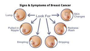 Besides swollen lymph nodes in the underarm region, you might also notice them around your collarbone. Signs And Symptoms Of Breast Cancer Medlux International Hospital