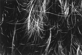 Piedra is the spanish word for stone. References In Itraconazole Therapy For White Piedra Affecting Scalp Hair Journal Of The American Academy Of Dermatology