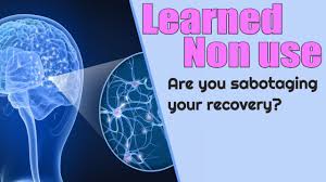 In the brain, the damaged cells are nerve cells (brain cells) known as neurons and neurons cannot regenerate. Can The Brain Heal After A Stroke Youtube