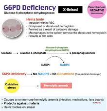Image result for G6PD Deficiency Detection