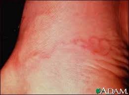 Petshed Petcyclopedia Human Risk From Cat Worms