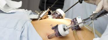 Menjaga haiwan selepas pembedahan dilakukan di klinik dan di rumah. Kaedah Laparoskopi Histerektomi Tempoh Selepas Pembedahan Kesan Ulasan Pembuangan Fibroid Rahim Laparoscopically Ulasan