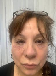 Skin Deep Anti-Aging Spa