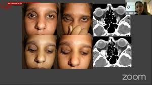 AIOC2021-IC648-Topic-Dr. SIMA DAS