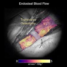 Long bone defect model, long bone growth cartilaginous model, long bone model, long bone. Bone Specific Kinetic Model To Quantify Periosteal And Endosteal Blood Flow Using Indocyanine Green In Fluorescence Guided Orthopedic Surgery Journal Of Biophotonics X Mol