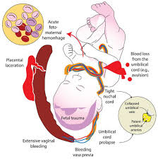 Image result for Neonatal Fluid Management