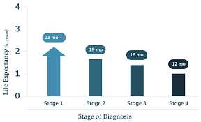 mesothelioma life expectancy how long do patients live