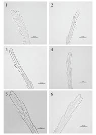 Image result for Pseudognaphalium oligandrum