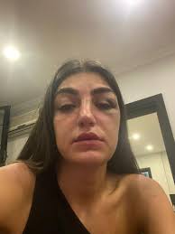Gizem akbaş, lavaboya gitmek için dışarı çıkmasını fırsat bilen mücahit i̇smail ayta hızla akbaş'ın yanına gitti. B26on2wa6ersjm
