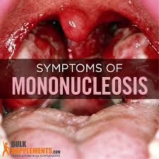 These viruses cause the common cold, sore throats, and bronchitis.; Mononucleosis Transmission Symptoms Treatment