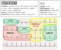 I've been in the field of integrative medicine for ten years, and am an internationally recognized expert in digestive health. Ekg Cheat Sheet Icu Nursing Cardiac Nursing Nursing Notes