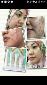 Most skin care ranges only targets the top 2 layer Produk Mary Kay Untuk Bekas Jerawat