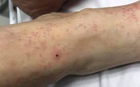 We did not find results for: Oculta Casos Por Rickettsia El Heraldo De Juarez Noticias Locales Policiacas Sobre Mexico Chihuahua Y El Mundo