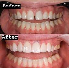 Pin On The Best Brantford Dentists