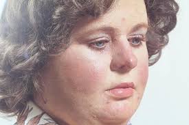 Sold at Auction: Duane Hanson, Signed Duane Hanson BusStop Lady Exhibition  Poster 1984