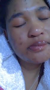 Dealing with Bullying: Overcoming Hurtful Comments