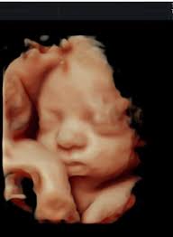 With Tomi Sue Thornton Pata in 2019. Come a long way since our assigned  seat behind Mrs. Adams