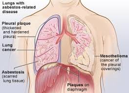 Pin On Health