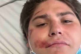 Fundraiser by Lily Balden : Thomas's Bike Accident Recovery Fund