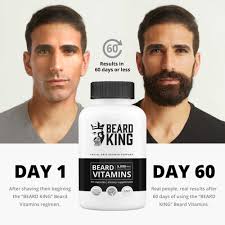 Biotin Pills For Hair Growth Before And After Beard King Beard Vitamins Best Facial Hair Growth Supplement For Thicker Fuller Healthy Beard W Hair Growth Pills Hair Growth Supplement Facial Hair Growth