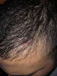 Pin On Hair And Style
