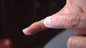 We did not find results for: Bat Bites Sleeping Colorado Woman In Her Bedroom Cbs Denver