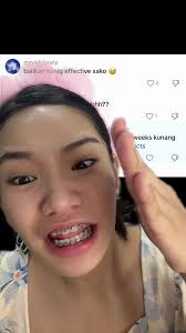 #niczab #foryou #trending #bisaya #fyp @dermorepubliq