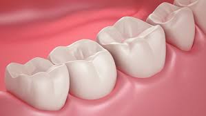 Why Dentin Is Just As Important As Tooth Enamel Wisdom Teeth Recovery After Wisdom Teeth Removal Wisdom Tooth Extraction