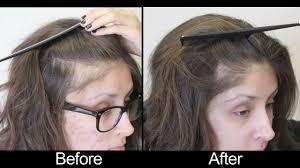Evolution Hair Loss Institute