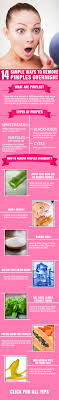 How To Get Rid Of Pimples Overnight Fast How To Remove Pimples Skin Treatments Remove Pimples Overnight