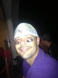 Ryan Whitlock's AVM Awareness